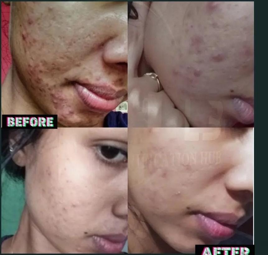 L3 Nutrification Hub